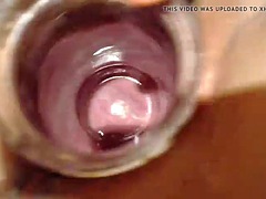 Jar and funnel in the pussy stretch and show the cervix